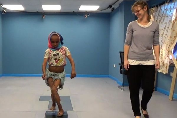 Clinical Gait Analysis